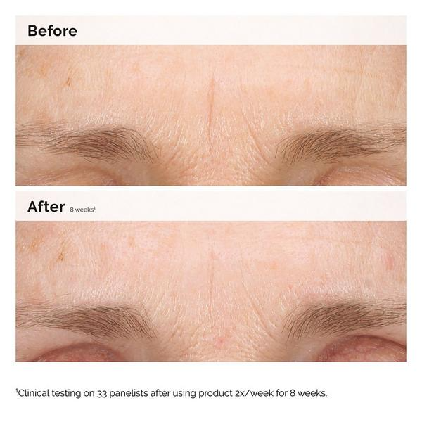 Emulsión Retinal 0,2% - The Ordinary