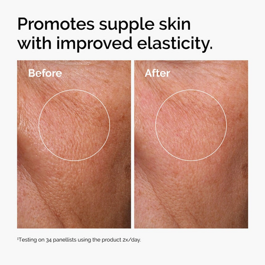 Ácido Hialurónico 2% + B5 (con Ceramidas) - THE ORDINARY